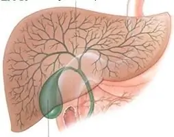 mob nyob rau hauv txoj cai hypochondrium tom qab noj mov