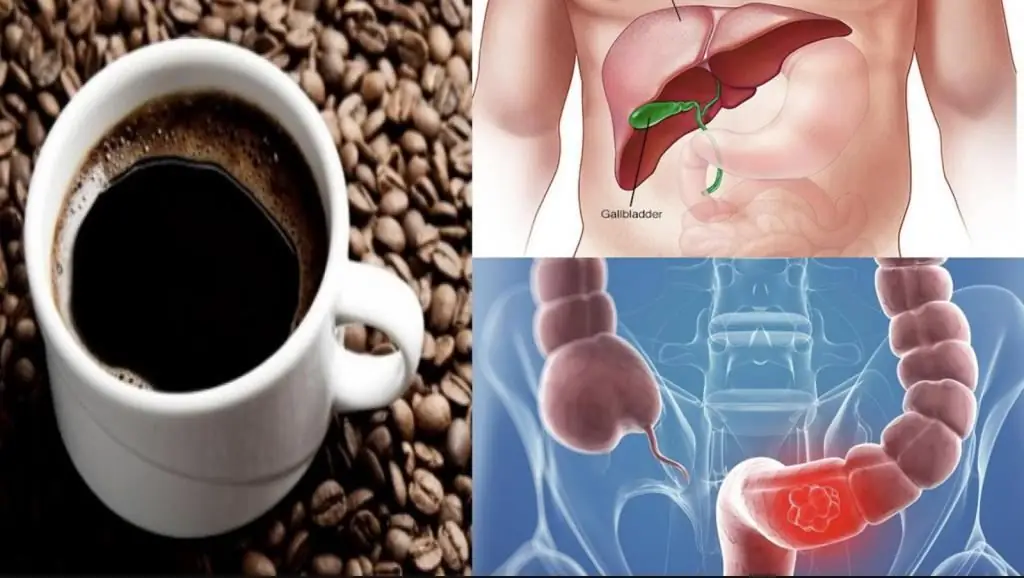 Koffie op een lege maag: de schade van koffie, het effect op het menselijk lichaam, maagirritatie, regels en kenmerken van het ontbijt